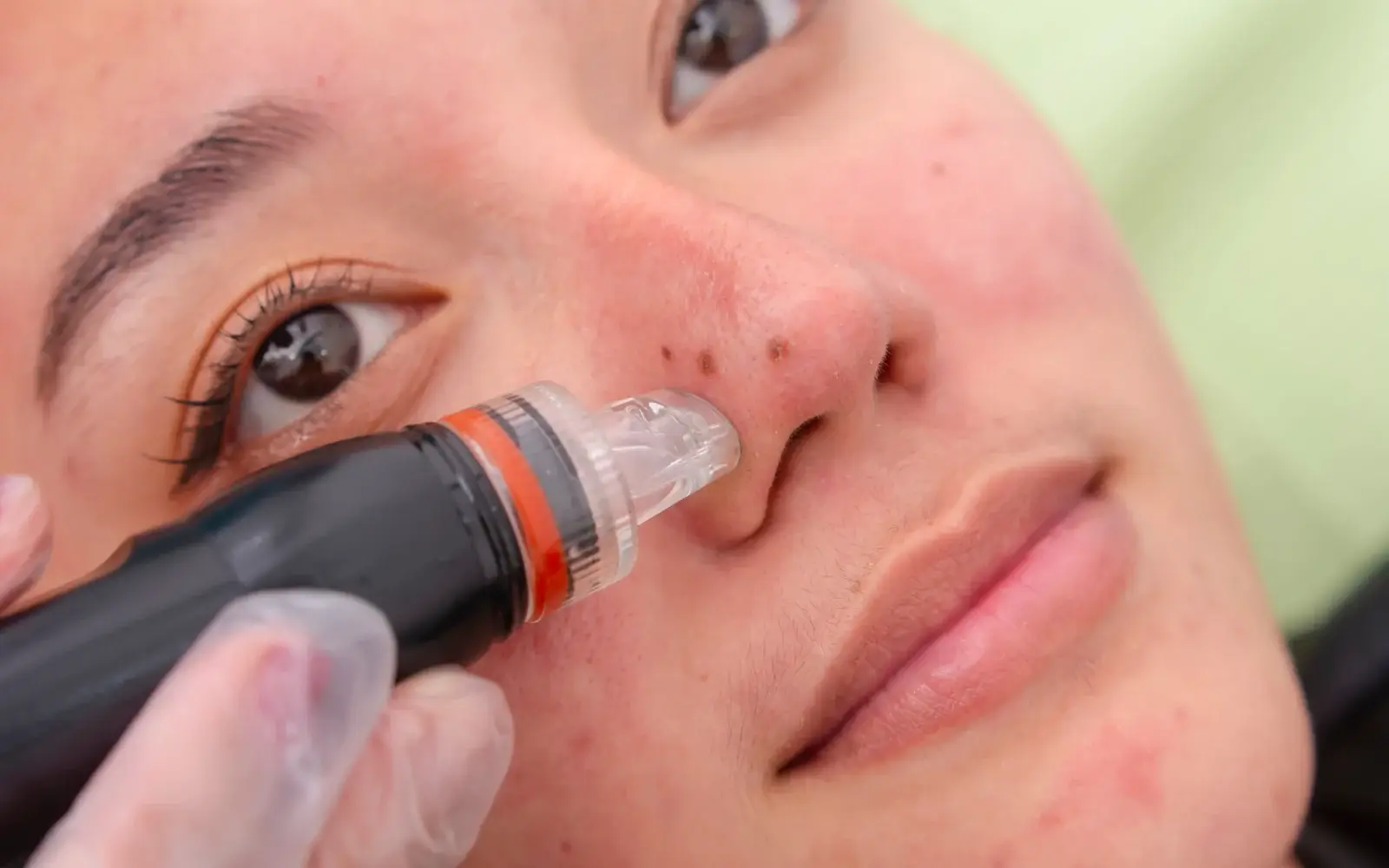 Serum being infused into the skin during an AquaFirme XS facial at a South Tempe, AZ clinic