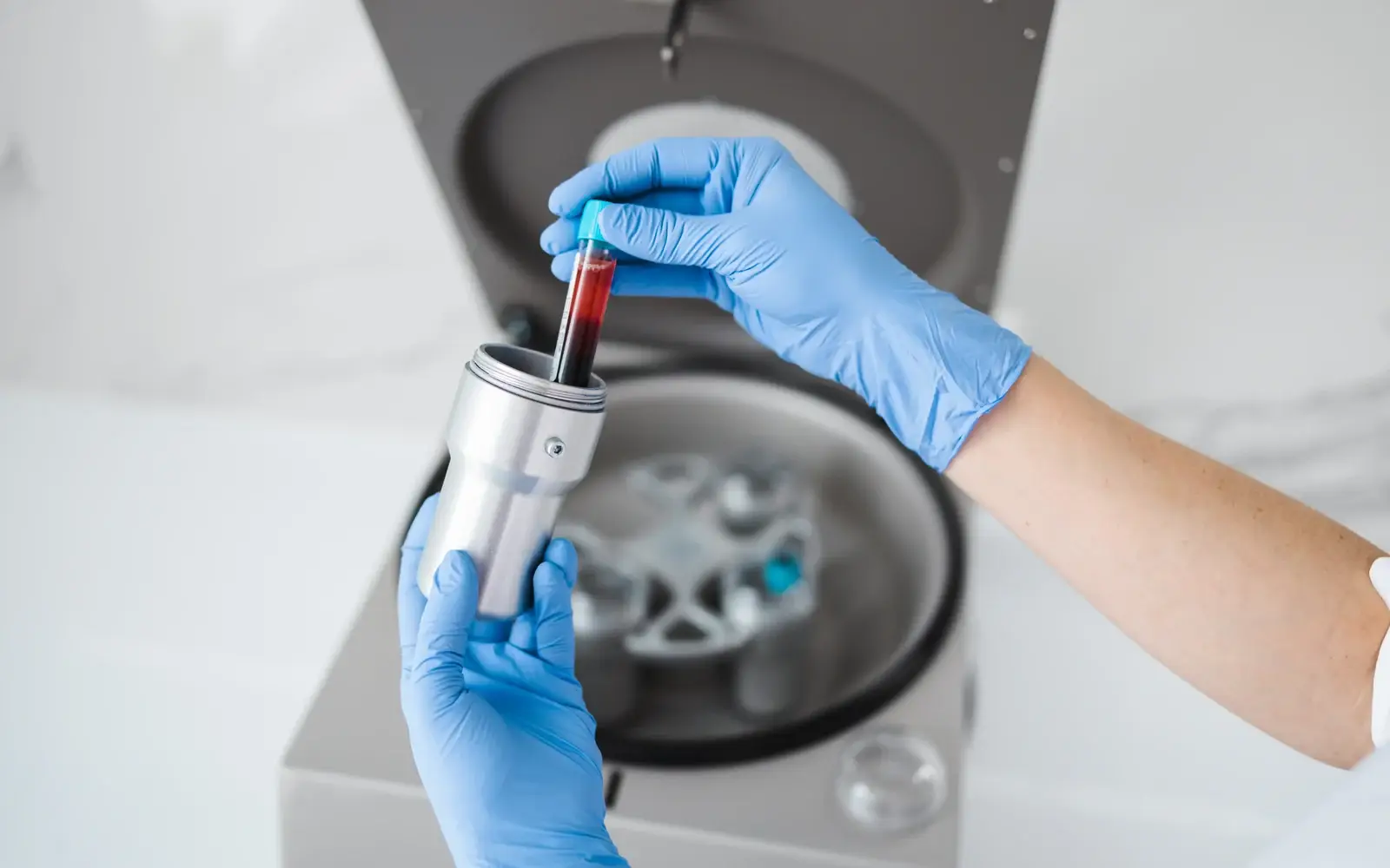 A blood sample being spun in a centrifuge to prepare platelet-rich plasma for erectile dysfunction treatment in South Tempe, AZ