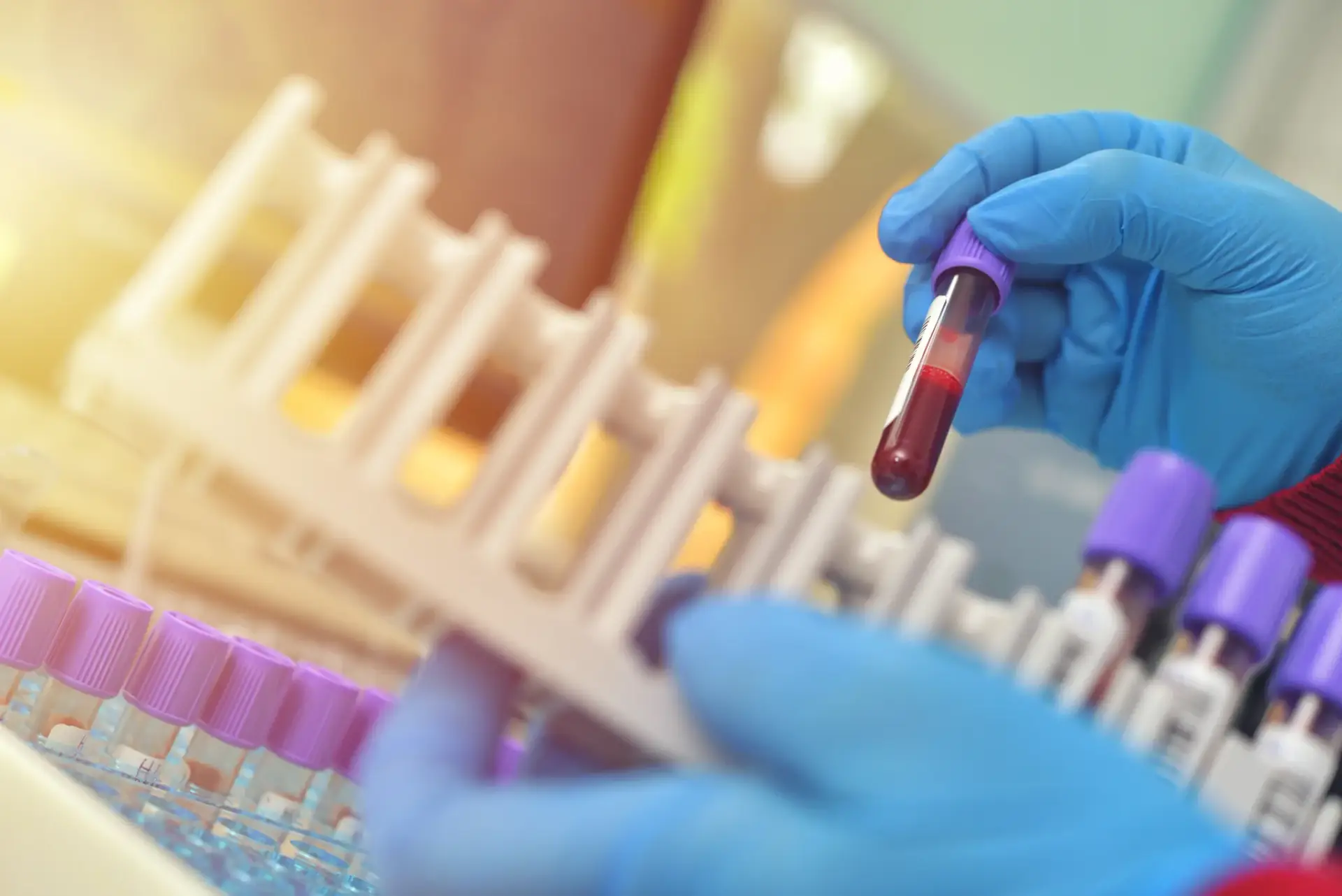 Blood samples prepared for the targeted diagnostic testing used in functional medicine in South Tempe, AZ