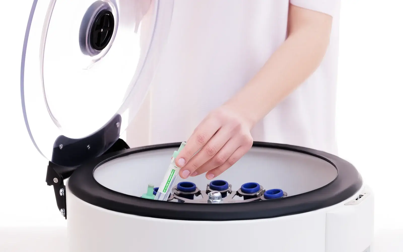 A blood sample being prepared as platelet-rich plasma for hair loss treatment in South Tempe, AZ