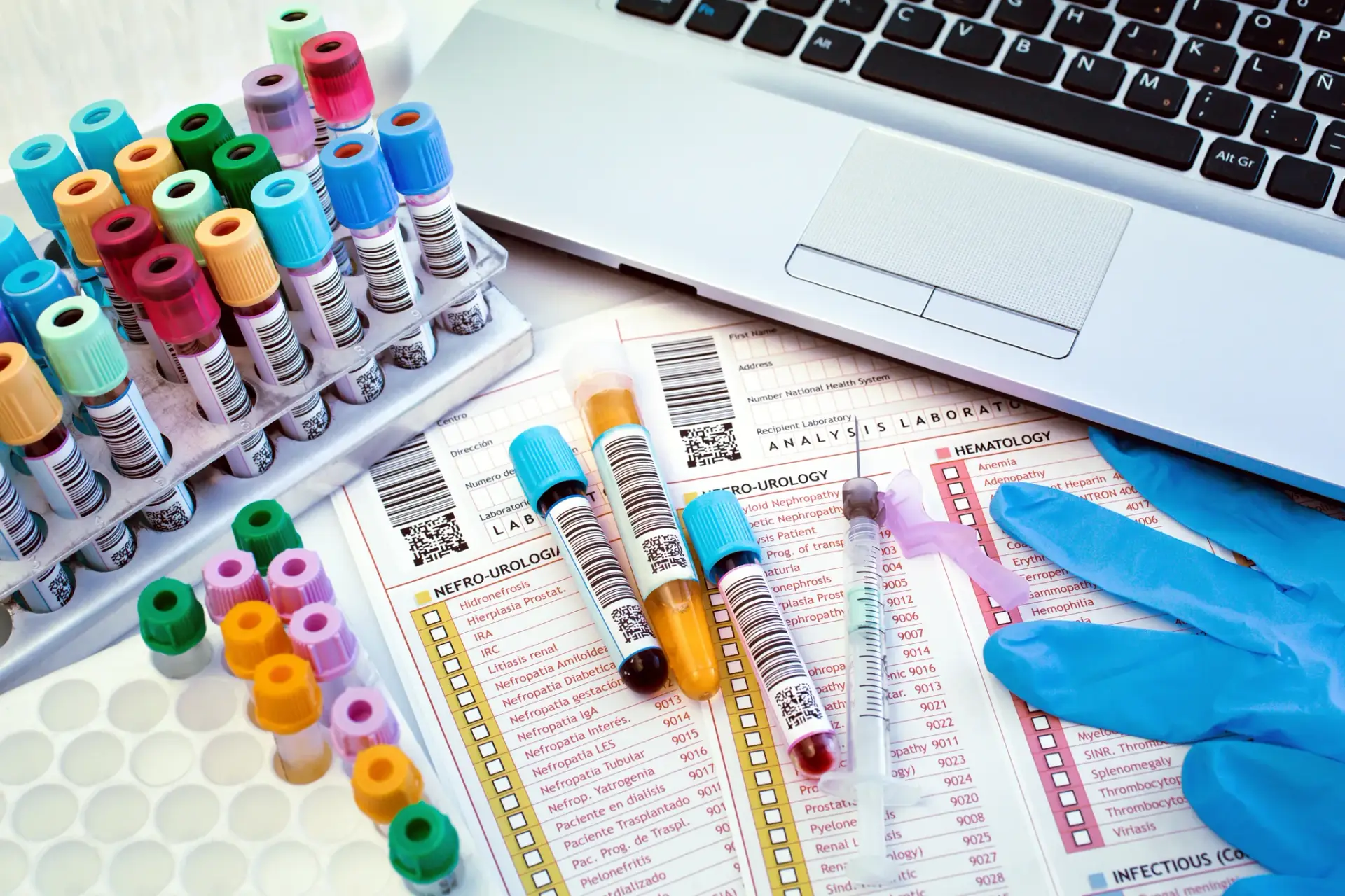 Blood samples prepared for the hormone panel that guides HRT for men in South Tempe, AZ