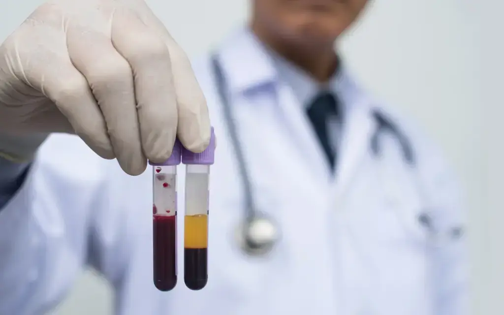 Physician holding blood and separated platelet-rich plasma tubes for a PRP facial in Tempe, AZ