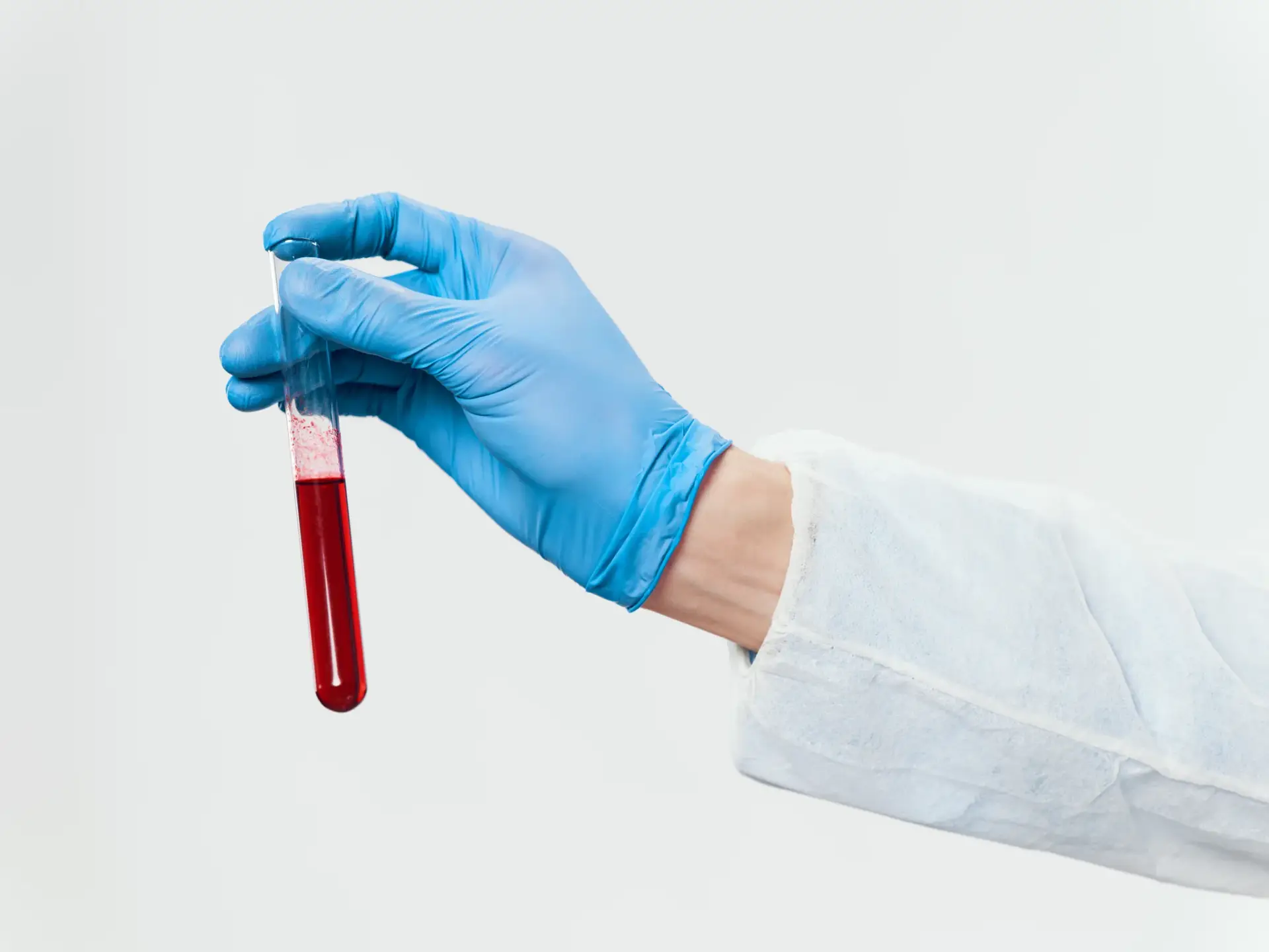 A blood sample prepared for the laboratory testing that guides naturopathic care in South Tempe, AZ