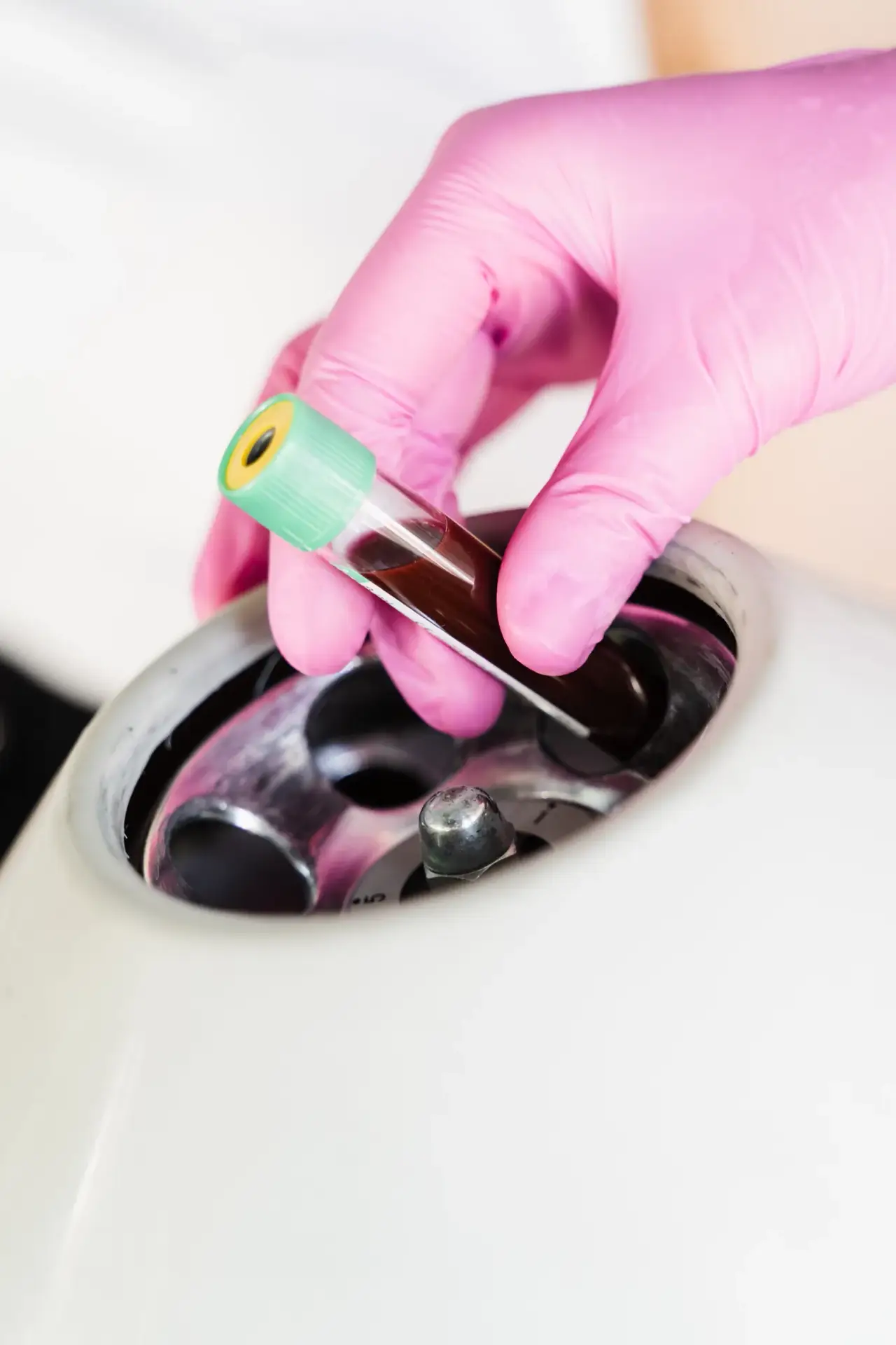 Platelet-rich plasma being separated in a centrifuge at a South Tempe, AZ clinic
