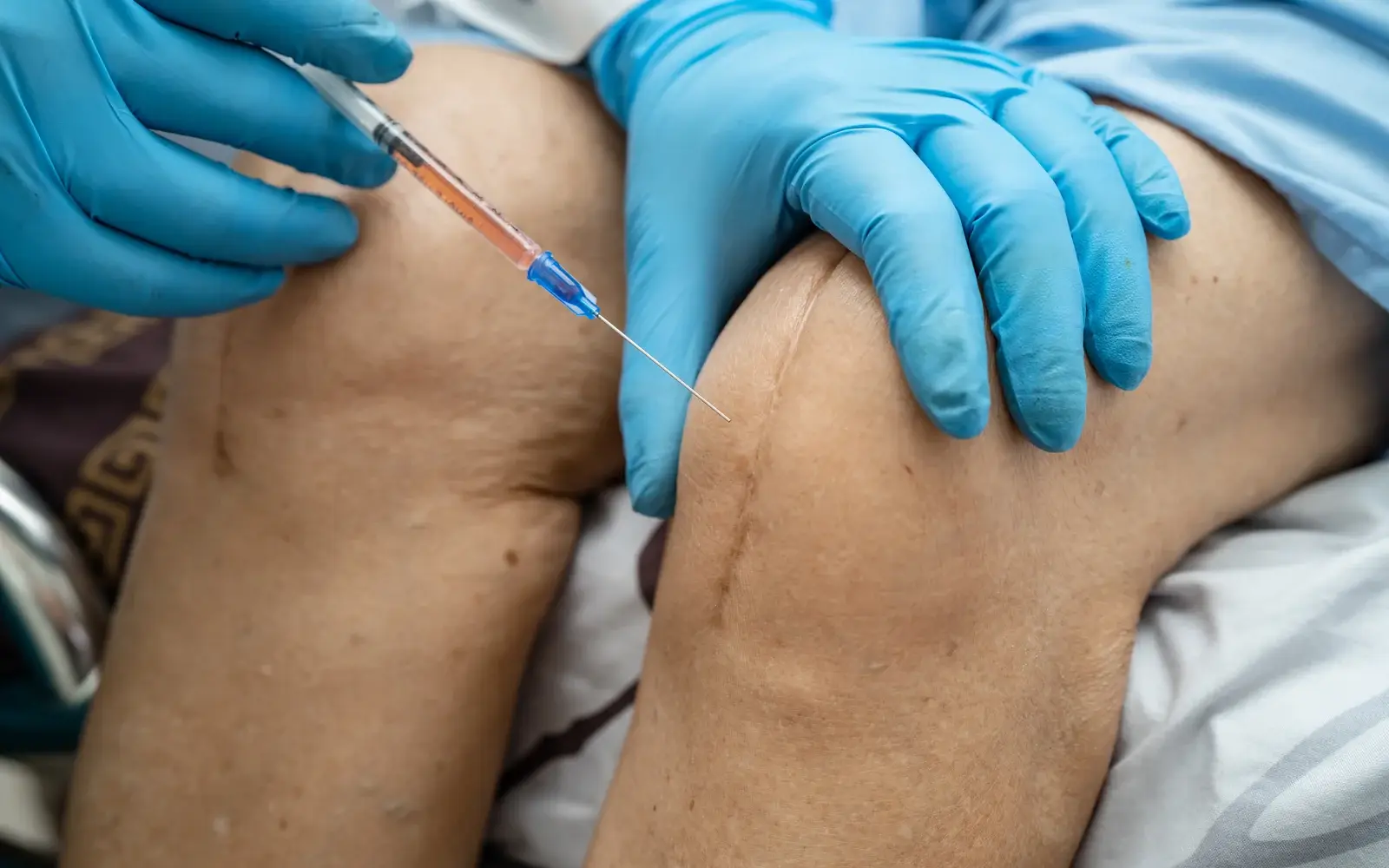 A physician treating a patient shoulder with a regenerative injection in South Tempe, AZ